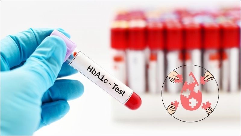 Các bệnh lý về máu có thể ảnh hưởng đến kết quả xét nghiệm HbA1c