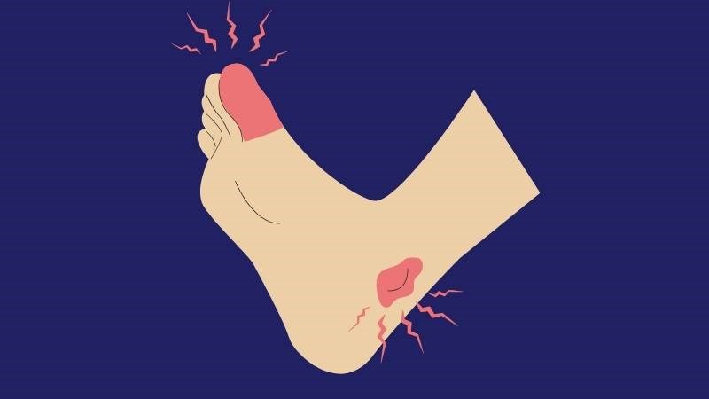 Đau mắt cá chân cũng có thể là triệu chứng của bệnh gout