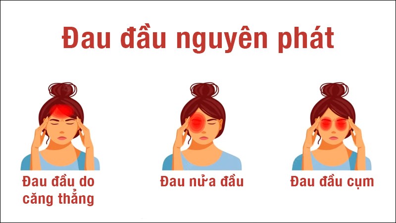 Nhức đầu là dấu hiệu của bệnh gì? Giải mã nguyên nhân và cách phòng ...