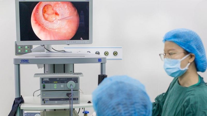 Phẫu thuật màng nhĩ giúp vá lỗ bị thủng Phẫu thuật màng nhĩ giúp vá lỗ bị thủng