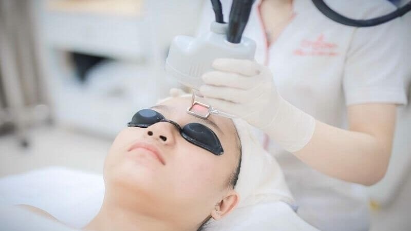 Laser là phương pháp hiệu quả điều trị sẹo