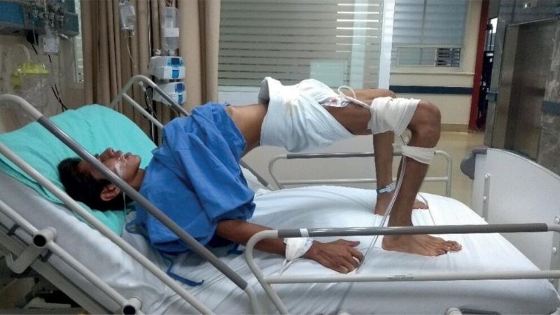 Người mắc bệnh uốn ván có nguy cơ tử vong cao