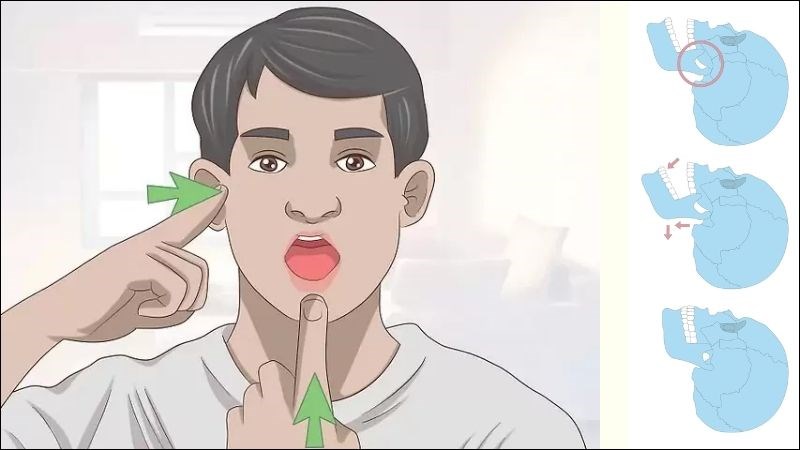 Bài tập mở miệng toàn phần giúp kéo giãn căng cơ hàm