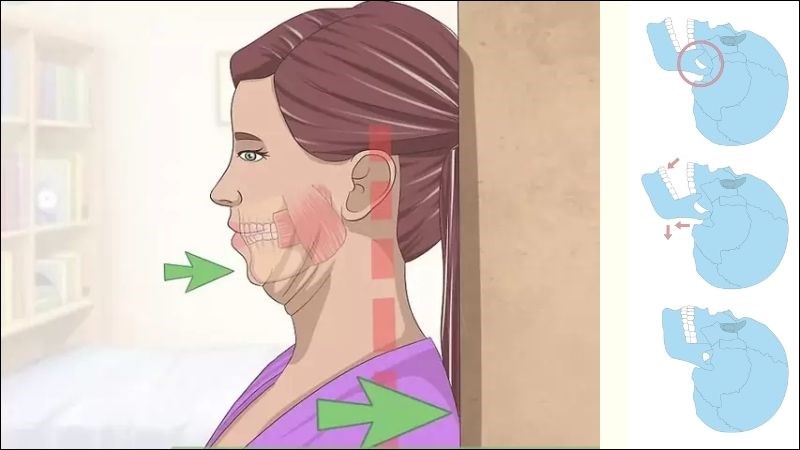 Bài tập gập cằm giúp thư giãn nhiều vùng cơ xung quanh khớp thái dương hàm