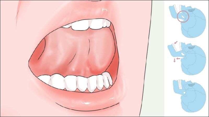Bài tập nâng lưỡi giúp giảm căng cứng cơ vùng hàm