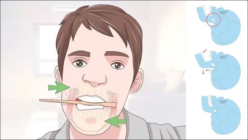 Bài tập chuyển động hàm làm tăng tính di động cho khớp thái dương hàm