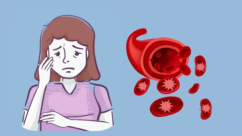 Thiếu máu tán huyết là tình trạng thiếu hụt số lượng hồng cầu do bị vỡ