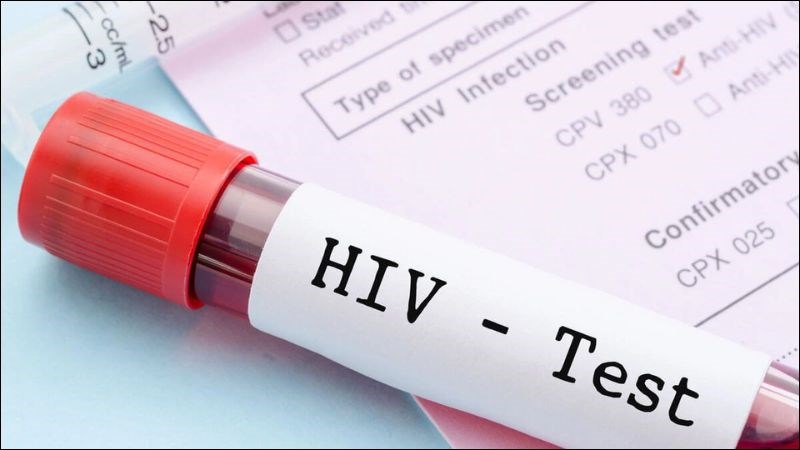 Điều trị thuốc kháng virus cho người nhiễm HIV càng sớm càng tốt khi có kết quả khẳng định