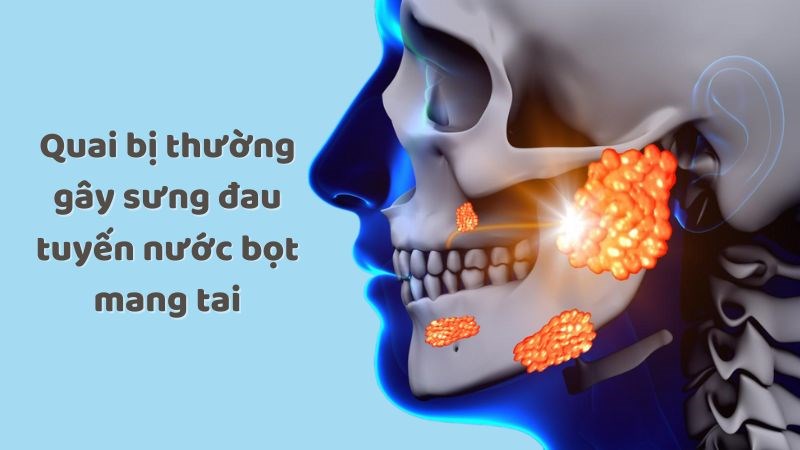 Quai bị thường gây sưng đau tuyến nước bọt mang tai