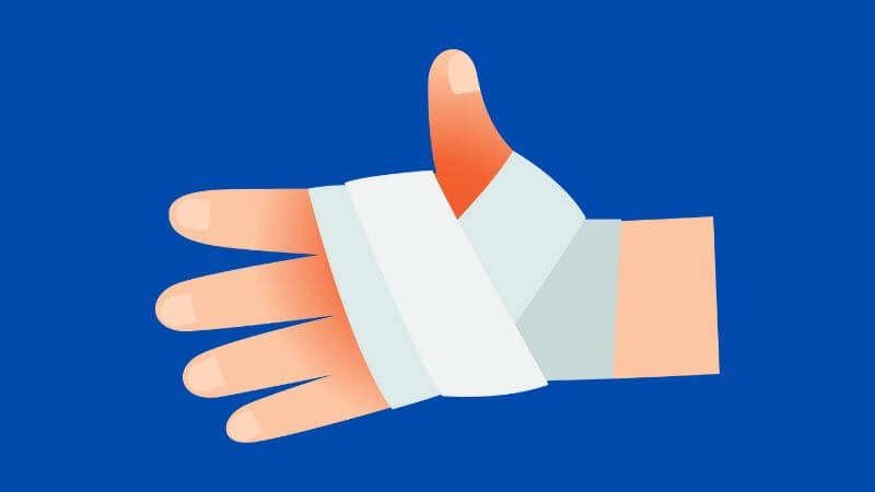 Bỏng khiến cho thể tích huyết tương giảm Bỏng khiến cho thể tích huyết tương giảm