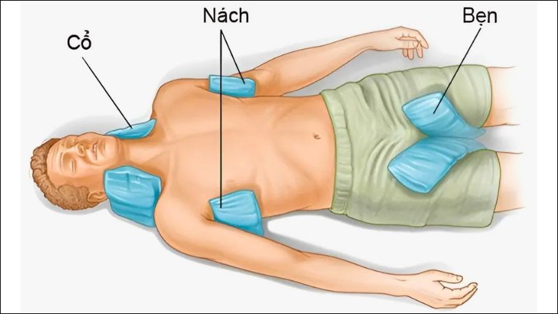 Cần chú trọng làm mát các vị trí có động mạch lớn cho người bị sốc nhiệt