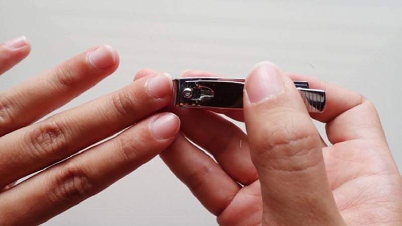 Cắt ngắn móng tay và hạn chế gãi giúp tránh lây lan virus