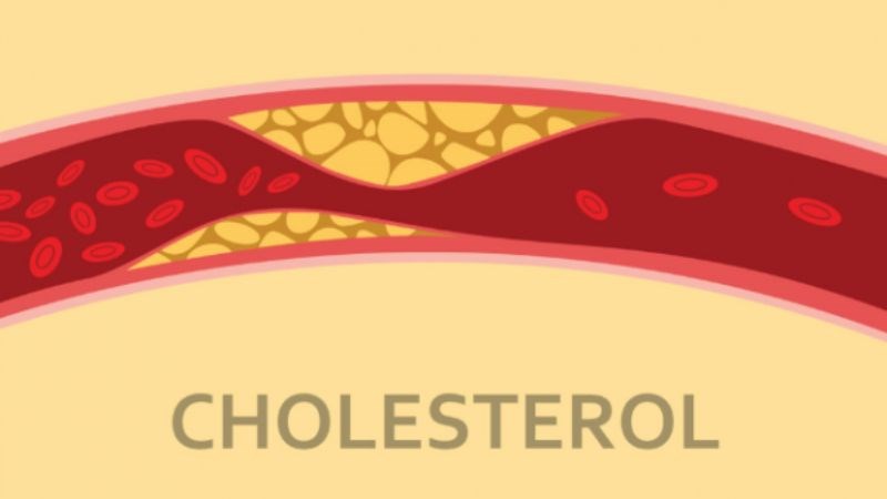 Mức cholesterol giảm sau thời gian sử dụng cần tây