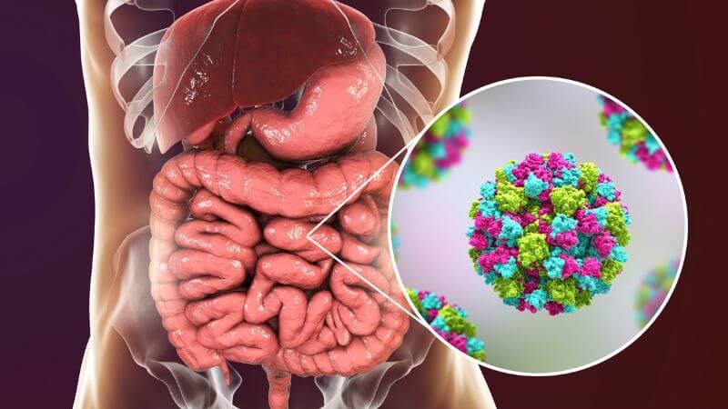 Viêm ruột là một trong những nguyên nhân gây ra rối loạn tiêu hóa