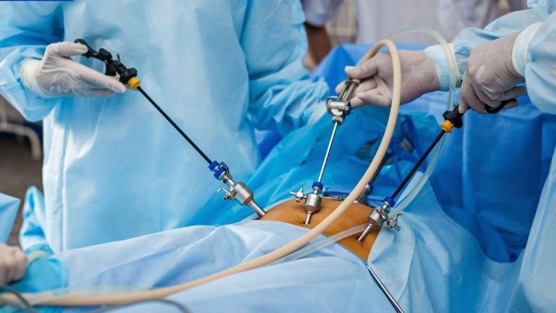 Phẫu thuật là phương pháp có thể điều trị khỏi hoàn toàn giãn tĩnh mạch thừng tinh