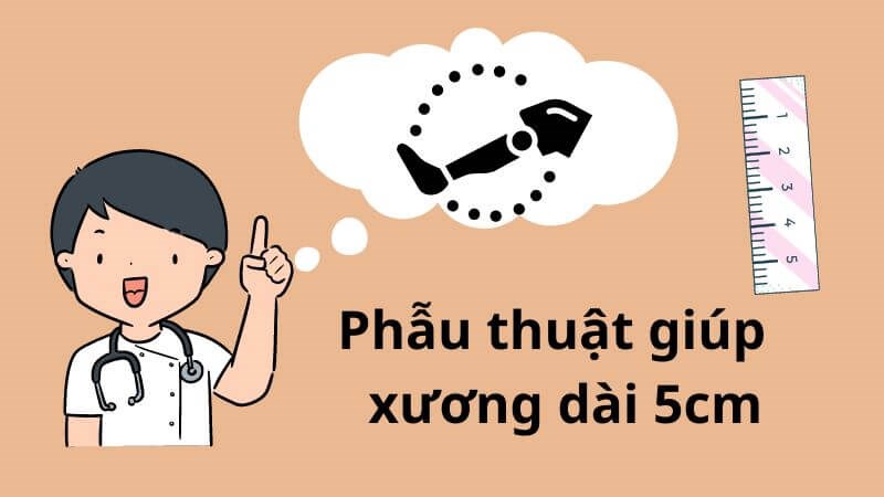 Phẫu thuật kéo dài chân có thể giúp xương dài ra 5 cm