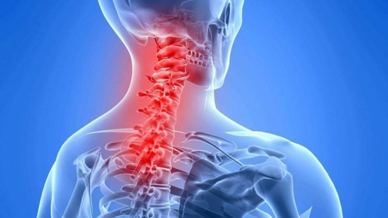 Đau vai gáy là tình trạng cơ vùng gáy bị co cứng gây các cơn đau nhức, khó chịu Đau vai gáy là tình trạng cơ vùng gáy bị co cứng gây các cơn đau nhức, khó chịu