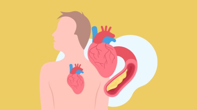 Nồng độ thủy ngân cao làm tổn thương mạch máu dẫn đến các bệnh tim mạch