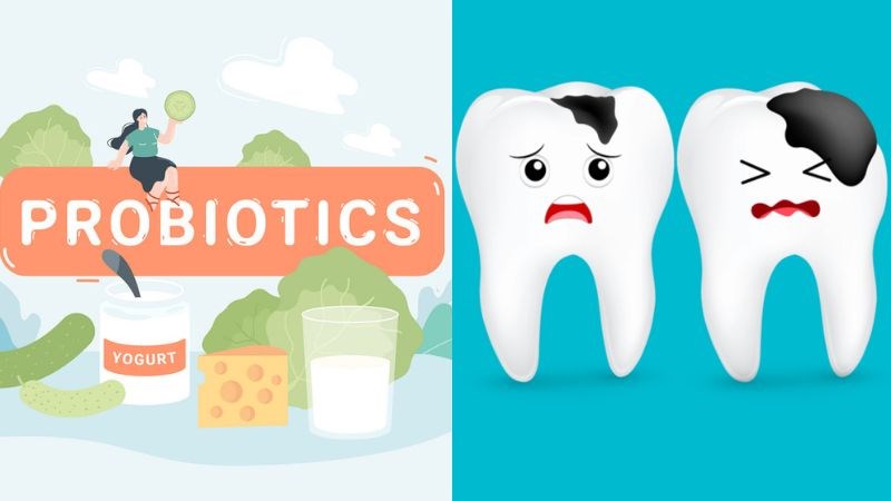 Men vi sinh giúp ngăn ngừa sâu răng và giảm nguy cơ mắc bệnh nướu răng Men vi sinh giúp ngăn ngừa sâu răng và giảm nguy cơ mắc bệnh nướu răng