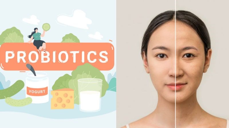 Sử dụng men vi sinh giúp làm chậm quá trình lão hóa da Sử dụng men vi sinh giúp làm chậm quá trình lão hóa da