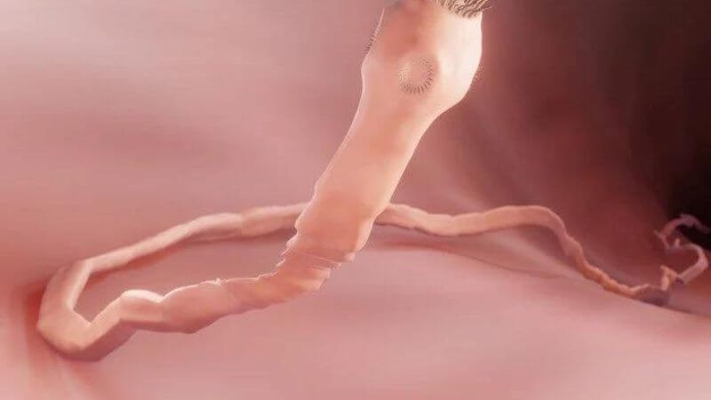 Sán lợn là sán dây tồn tại trong cơ thể lợn bệnh