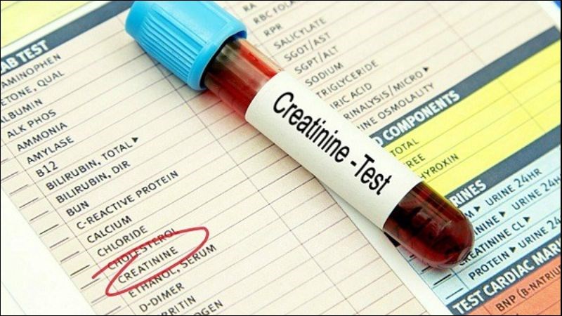 Xét nghiệm chức năng thận giúp hỗ trợ điều trị 