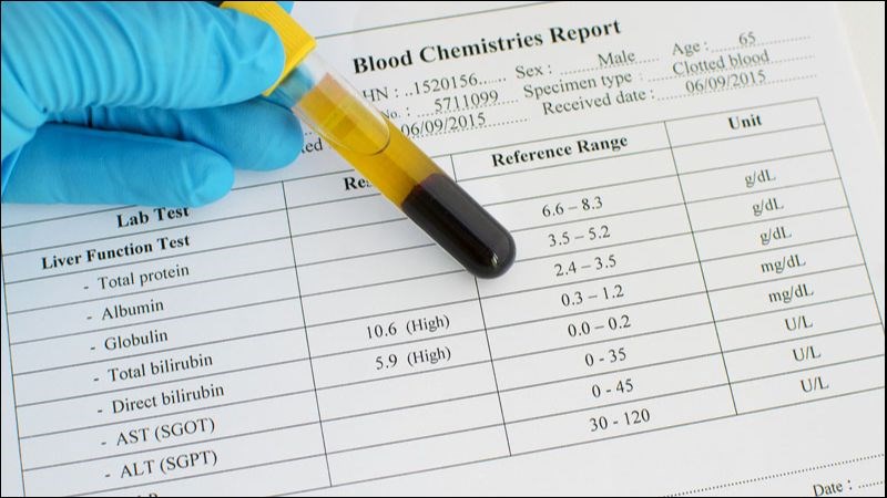 Đánh giá chức năng gan nhằm xác định tổn thương mà virus gây ra cho gan