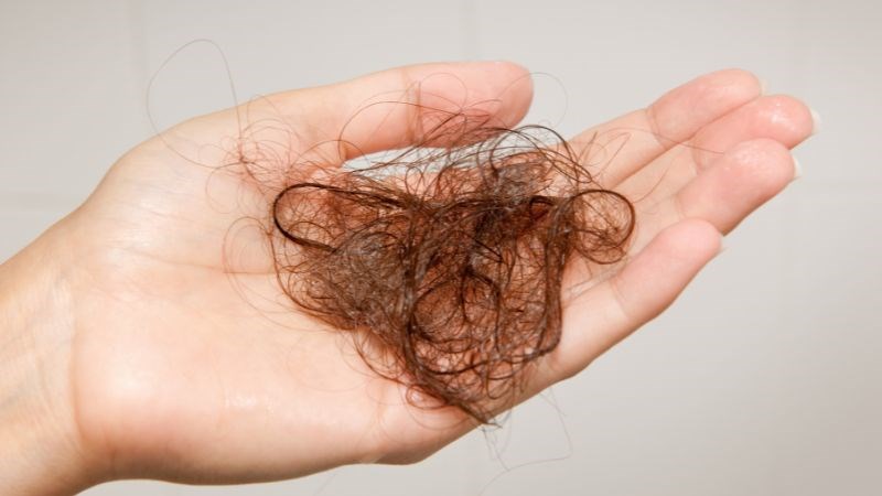 Rụng tóc là một trong những biểu hiện thiếu biotin