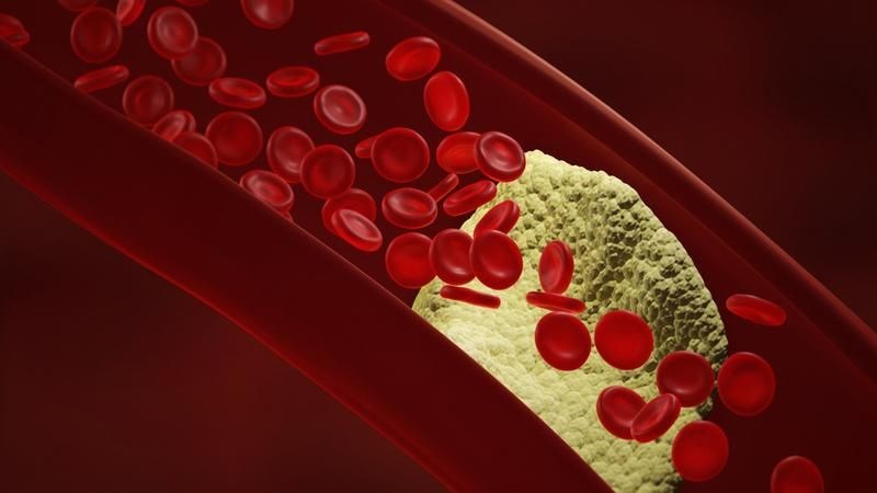 Vitamin K2 giúp giảm tình trạng vôi hóa mạch máu