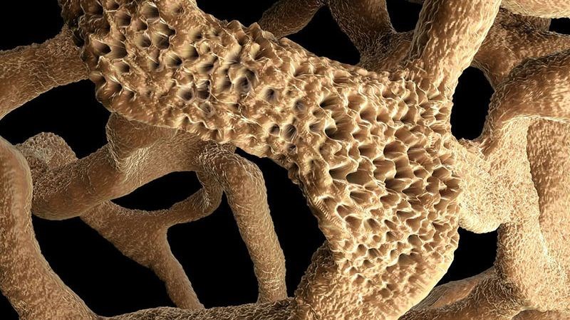 Vitamin K giúp ngăn ngừa loãng xương ở người cao tuổi