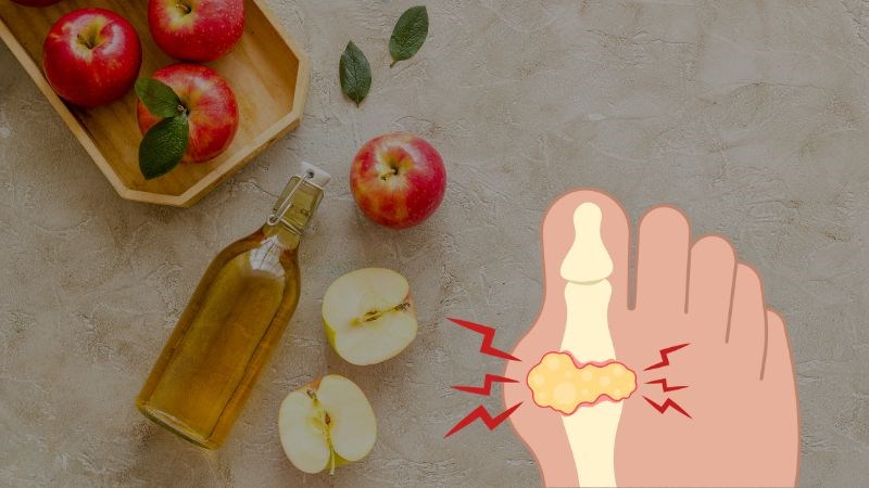 Axit axetic trong giấm táo giúp giảm các yếu tố nguy cơ gây bệnh gút
