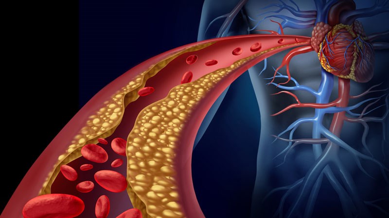 Cholesterol trong máu giảm khi được điều trị bằng tinh dầu sả