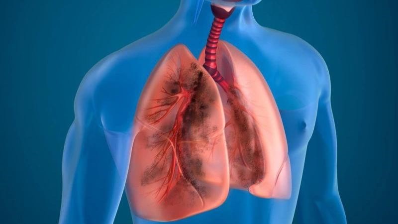 Ginkgo Biloba chứa các hợp chất chống viêm giúp cải thiện các triệu chứng của COPD