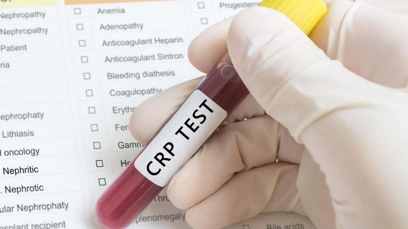 CRP là một chỉ số để xác định và đánh giá tình trạng viêm hoặc nhiễm trùng