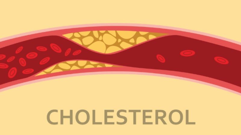 Gừng hỗ trợ giảm nồng độ cholesterol