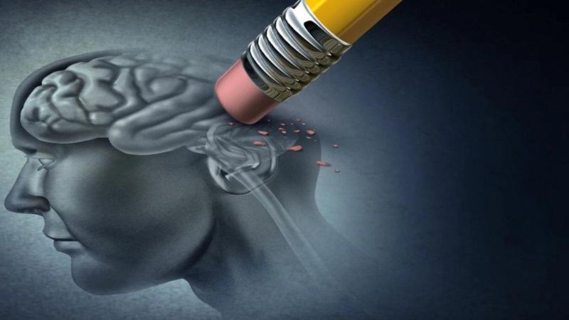 Thường xuyên sử dụng đường có thể làm tăng nguy cơ mắc Alzheimer