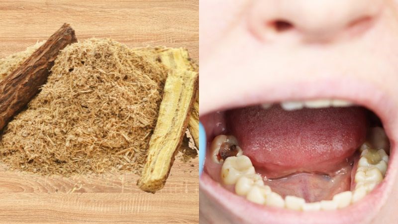 Cam thảo hỗ trợ chống sâu răng