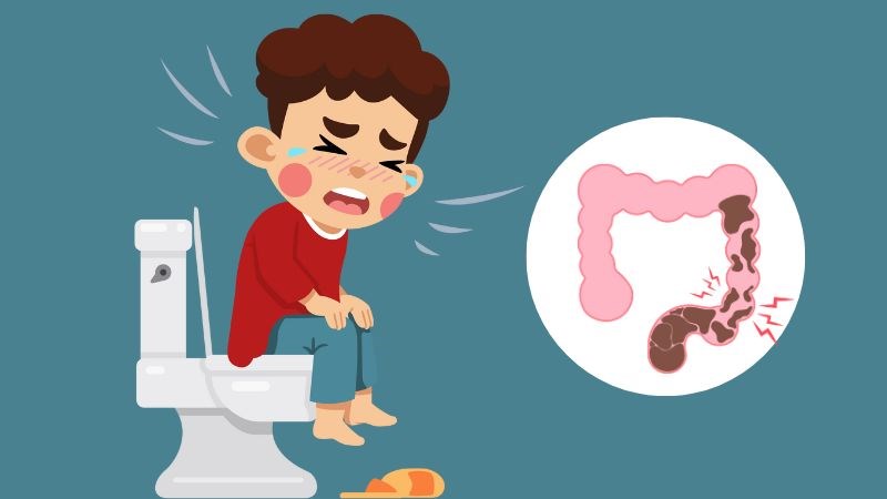 Táo bón là khi một người có ít hơn 3 lần đi tiêu trong một tuần.
