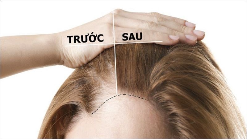 Dưỡng chất trong dầu cà rốt giúp mang lại hiệu quả kích thích tóc phát triển