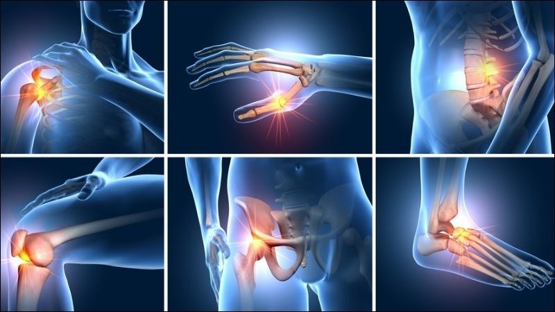 Dầu cá và dầu hạt lanh có khả năng làm giảm các triệu chứng của bệnh viêm khớp Dầu cá và dầu hạt lanh có khả năng làm giảm các triệu chứng của bệnh viêm khớp