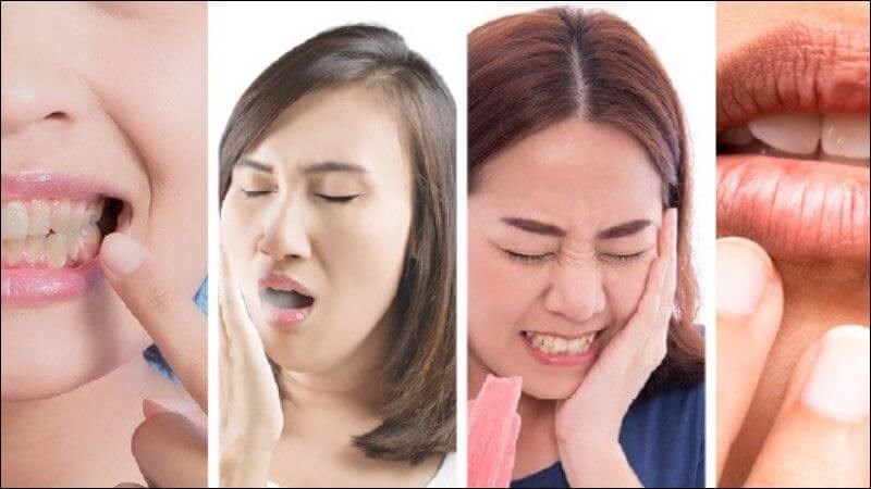 Tinh dầu chanh có đặc tính kháng khuẩn và kháng nấm giúp cải thiện sức khỏe răng miệng