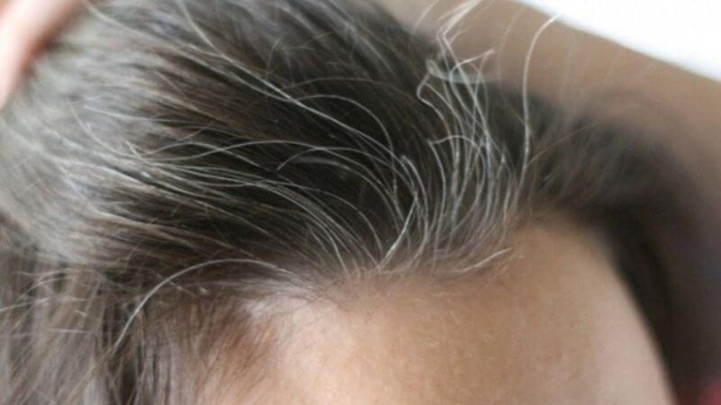Dầu hạt lanh giúp ngăn ngừa tình trạng tóc bạc sớm 