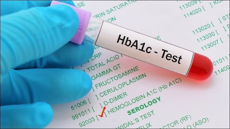 Xét nghiệm HbA1C được thực hiện vào bất kỳ thời điểm nào mà không cần nhịn ăn