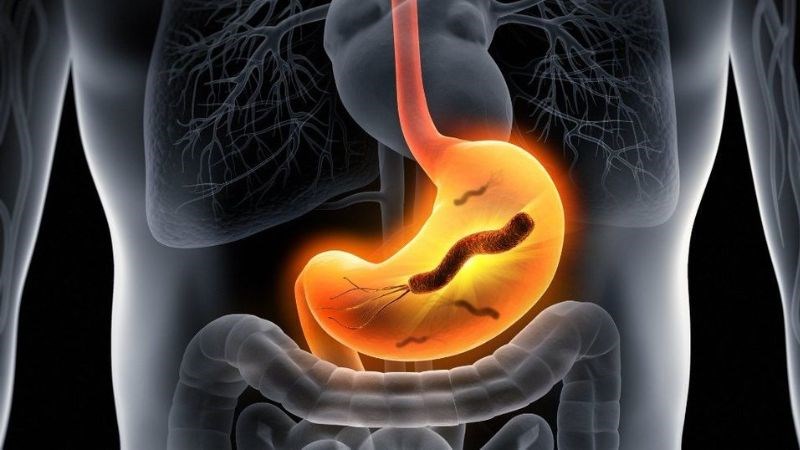 Nghệ tươi giúp điều trị niêm mạc dạ dày suy giảm do nhiễm Helicobacter pylori