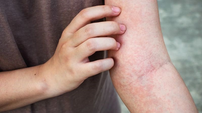 Long não giúp giảm sự ngứa ngáy trên da