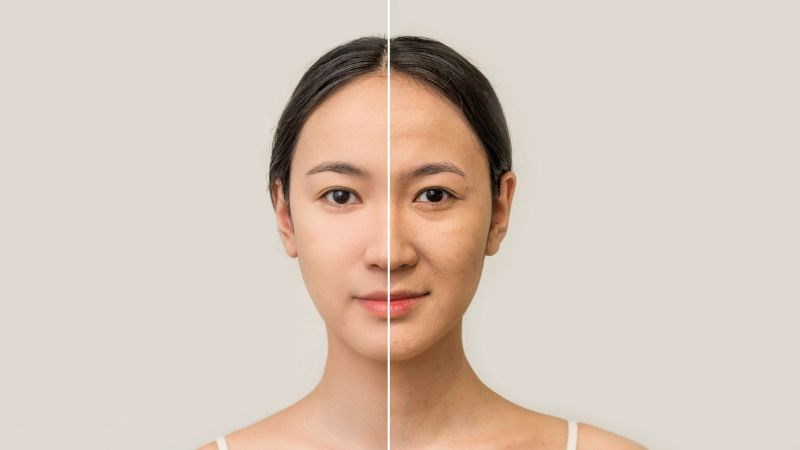 Mật ong Manuka là một trợ thủ đắc lực cho chị em, chống lại sự lão hóa của thời gian Mật ong Manuka là một trợ thủ đắc lực cho chị em, chống lại sự lão hóa của thời gian