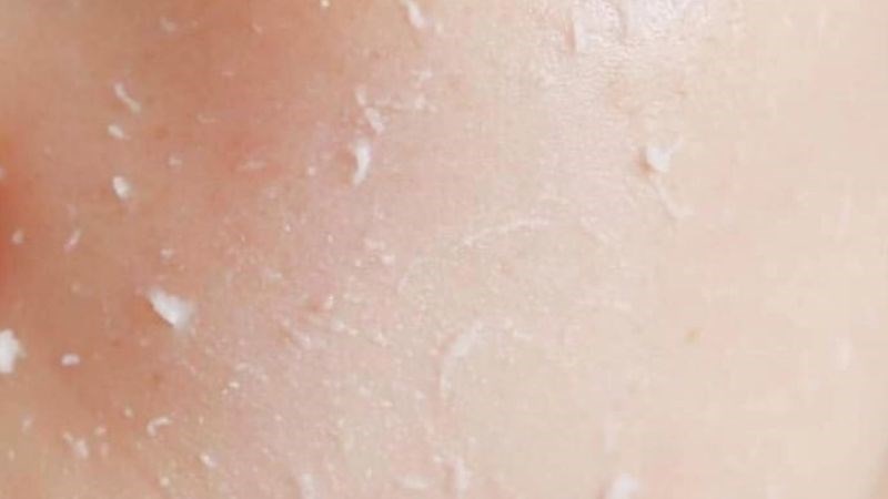 Hỗn hợp bột yến mạch với mật ong có thể giúp tẩy tế bào chết