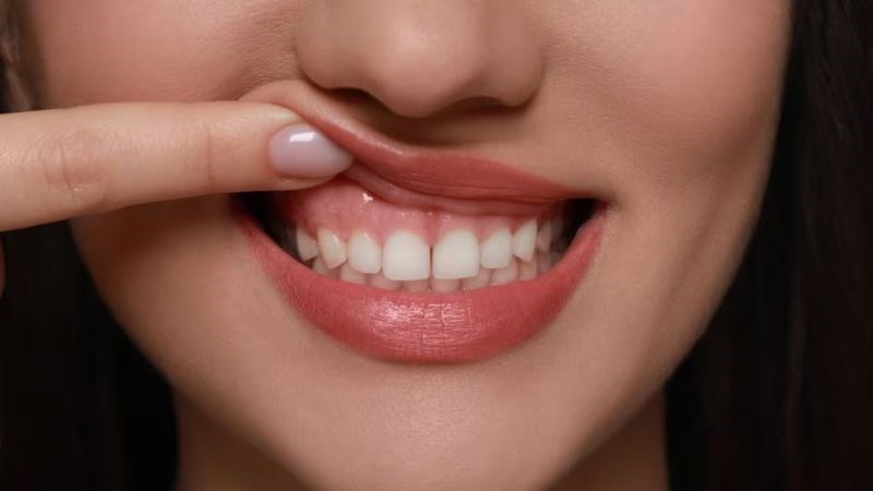 Bông cải xanh giúp làm giảm nguy cơ mắc bệnh nha chu