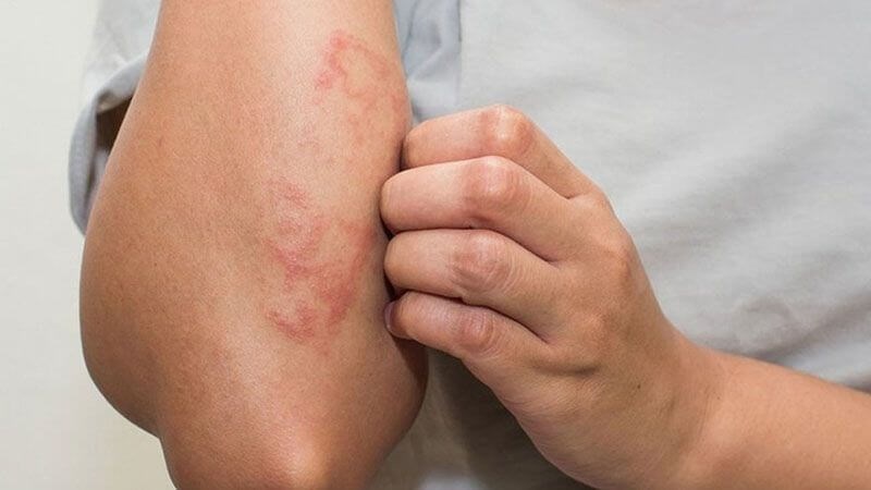 Tinh Dầu Đinh Hương: Giá Trị Vượt Ra Khỏi Mùi Hương Tinh Dầu Đinh Hương: Giá Trị Vượt Ra Khỏi Mùi Hương