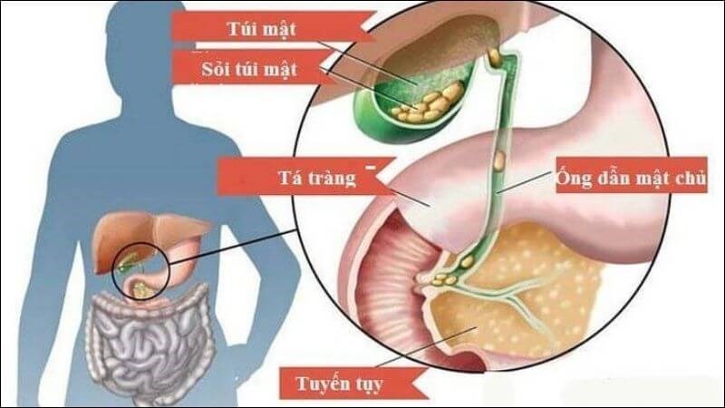 Cỏ lúa mạch có thể giúp ngăn ngừa sự hình thành sỏi mật